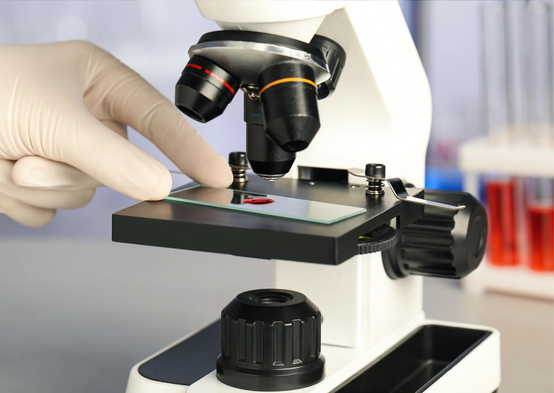Hematología atención